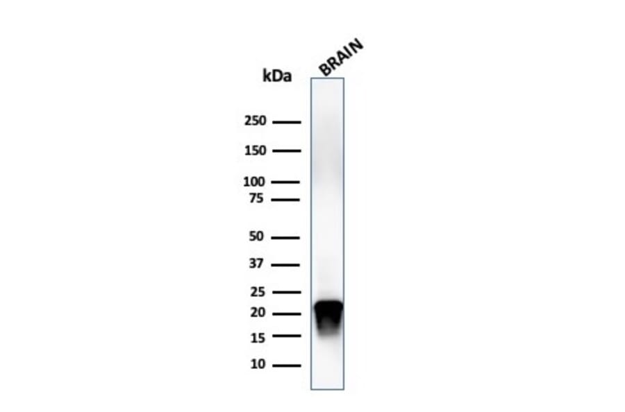 Western Blot - Anti-Myelin Basic Protein (phospho Thr98) Antibody [MBP/4276] (A249283) - Antibodies.com