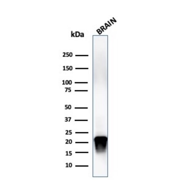 Western Blot - Anti-Myelin Basic Protein (phospho Thr98) Antibody [MBP/4276] (A249283) - Antibodies.com