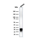 Western Blot - Anti-Myelin Basic Protein (phospho Thr98) Antibody [MBP/4276] (A249283) - Antibodies.com
