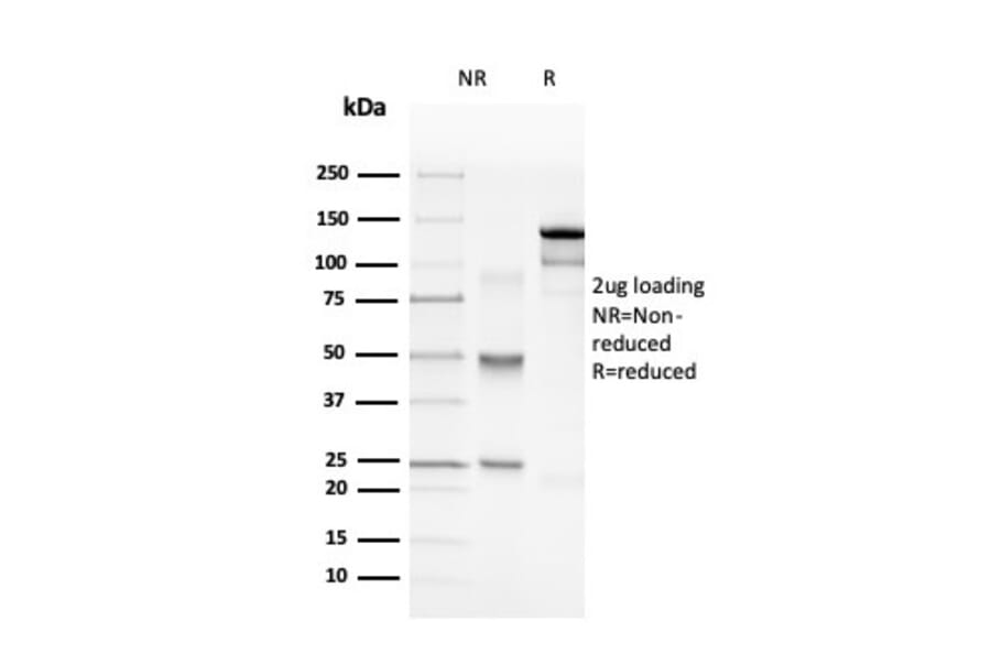 SDS-PAGE - Anti-Myelin Basic Protein Antibody [rMBP/4288] (A249284) - Antibodies.com