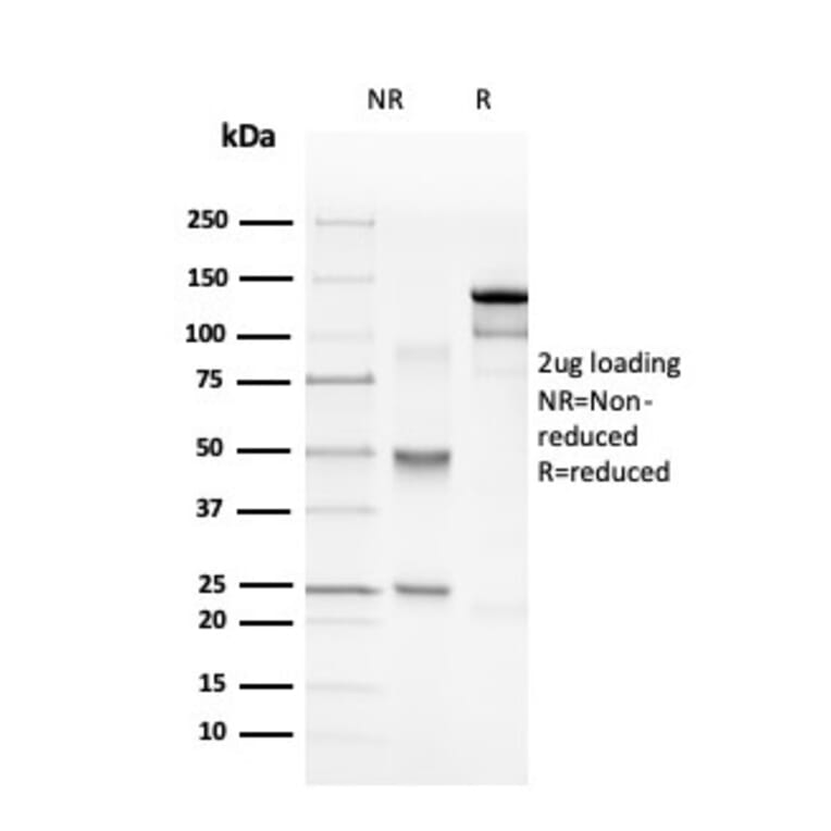 SDS-PAGE - Anti-Myelin Basic Protein Antibody [rMBP/4288] (A249284) - Antibodies.com