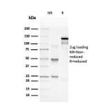 SDS-PAGE - Anti-Myelin Basic Protein Antibody [rMBP/4288] (A249284) - Antibodies.com