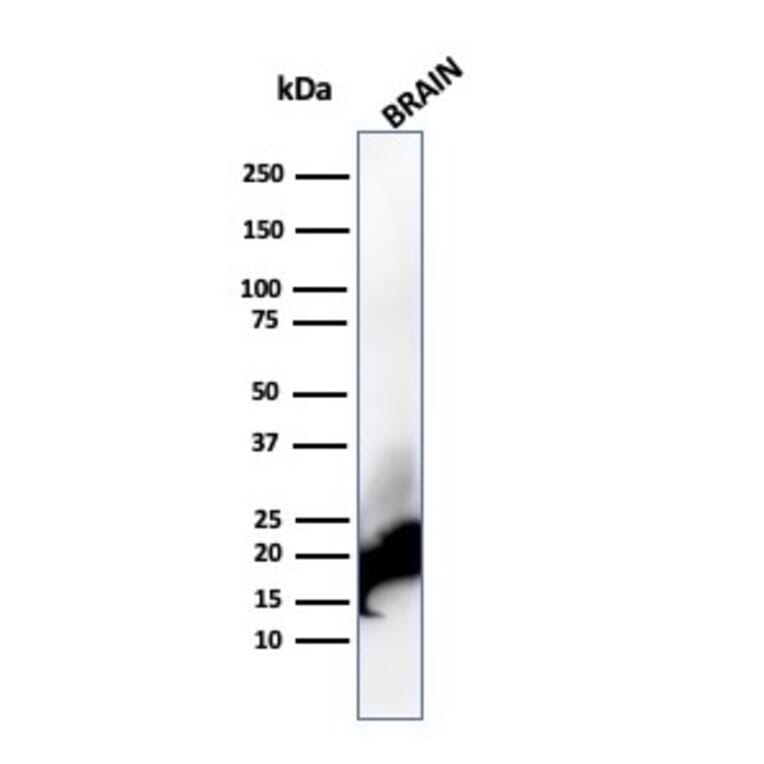 Western Blot - Anti-Myelin Basic Protein Antibody [rMBP/4288] (A249284) - Antibodies.com