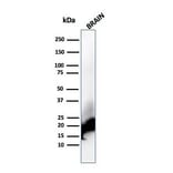 Western Blot - Anti-Myelin Basic Protein Antibody [rMBP/4288] (A249284) - Antibodies.com