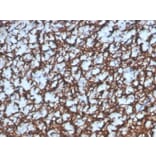 Immunohistochemistry - Anti-Myelin Basic Protein Antibody [MBP/4277R] (A249285) - Antibodies.com