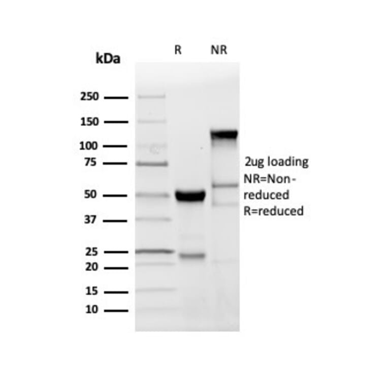 SDS-PAGE - Anti-Myelin Basic Protein Antibody [MBP/4277R] (A249285) - Antibodies.com