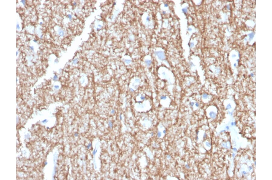 Immunohistochemistry - Anti-Myelin Basic Protein Antibody [MBP/4273] (A249286) - Antibodies.com