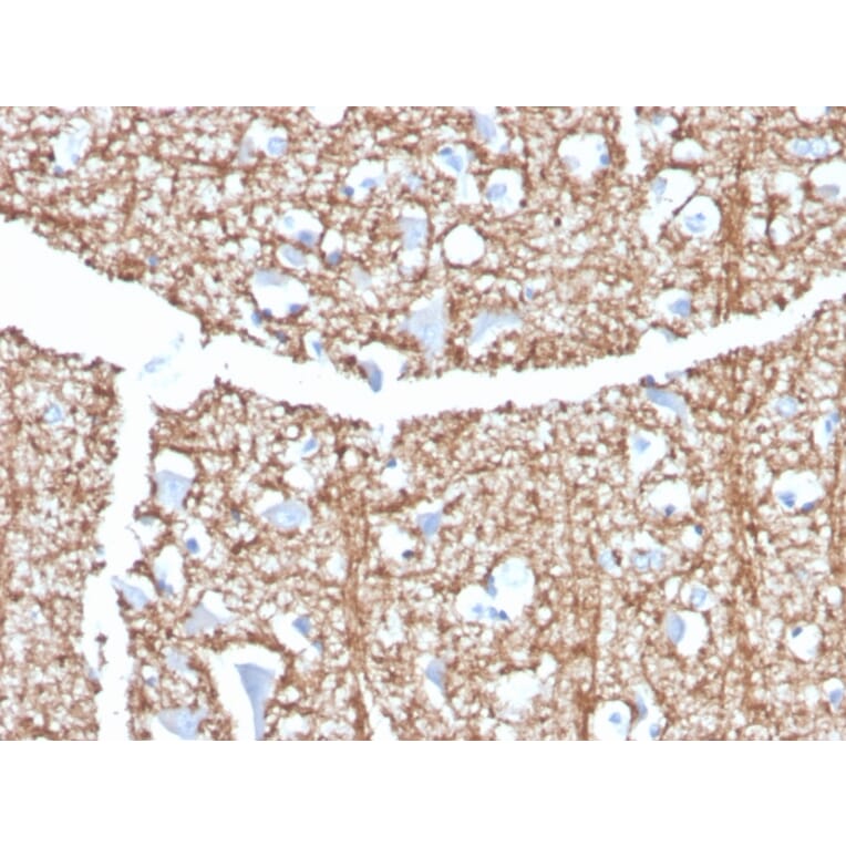 Immunohistochemistry - Anti-Myelin Basic Protein Antibody [MBP/4273] (A249285) - Antibodies.com