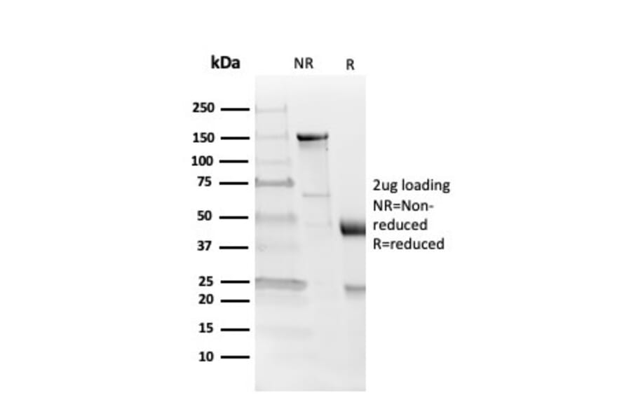 SDS-PAGE - Anti-Myelin Basic Protein Antibody [MBP/4273] (A249286) - Antibodies.com