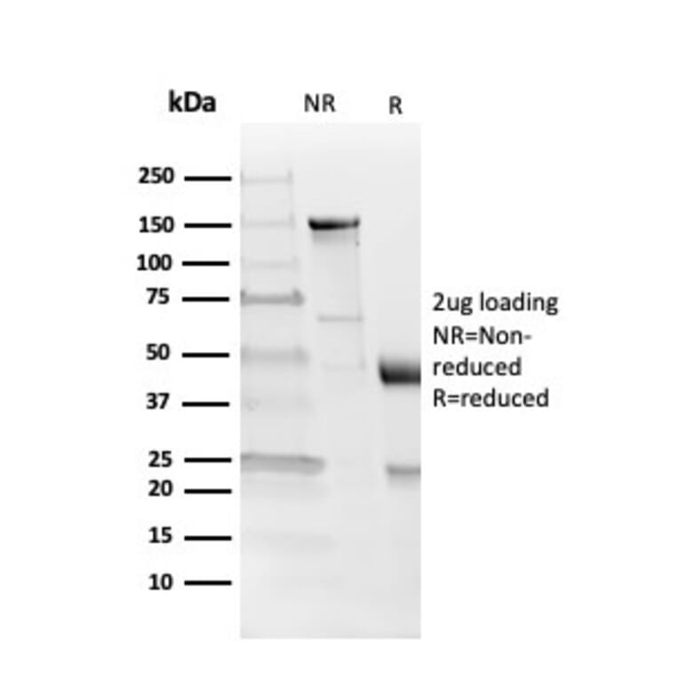 SDS-PAGE - Anti-Myelin Basic Protein Antibody [MBP/4273] (A249286) - Antibodies.com