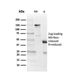 SDS-PAGE - Anti-Myelin Basic Protein Antibody [MBP/4273] (A249286) - Antibodies.com