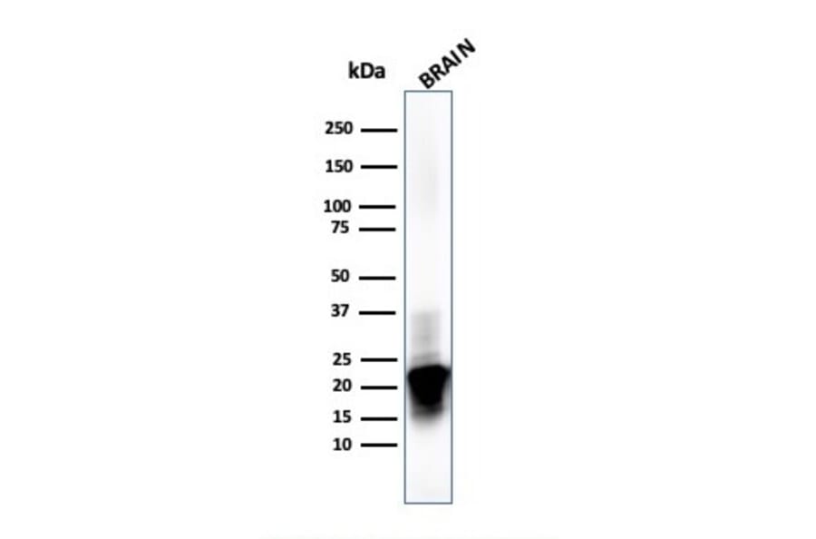Western Blot - Anti-Myelin Basic Protein Antibody [MBP/4273] (A249286) - Antibodies.com