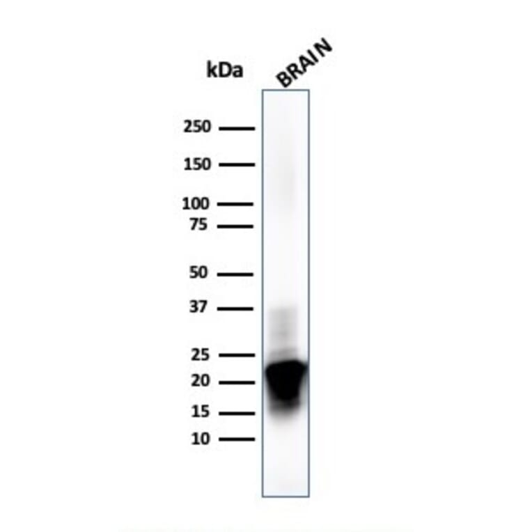 Western Blot - Anti-Myelin Basic Protein Antibody [MBP/4273] (A249286) - Antibodies.com