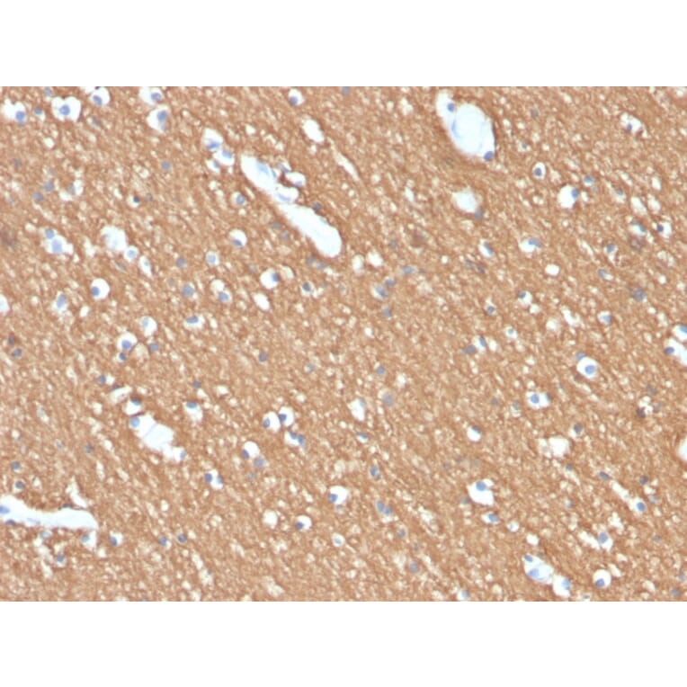 Immunohistochemistry - Anti-Myelin Basic Protein Antibody [MBP/4274] (A249287) - Antibodies.com