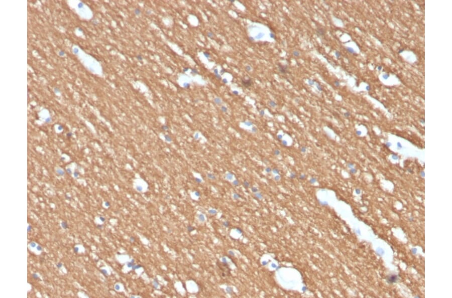Immunohistochemistry - Anti-Myelin Basic Protein Antibody [MBP/4274] (A249286) - Antibodies.com