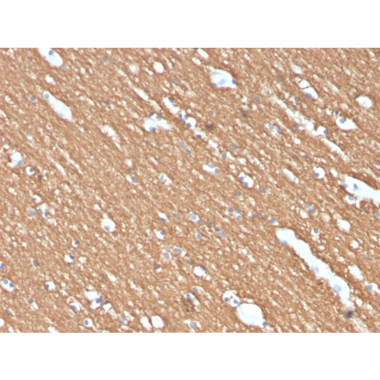 Immunohistochemistry - Anti-Myelin Basic Protein Antibody [MBP/4274] (A249286) - Antibodies.com