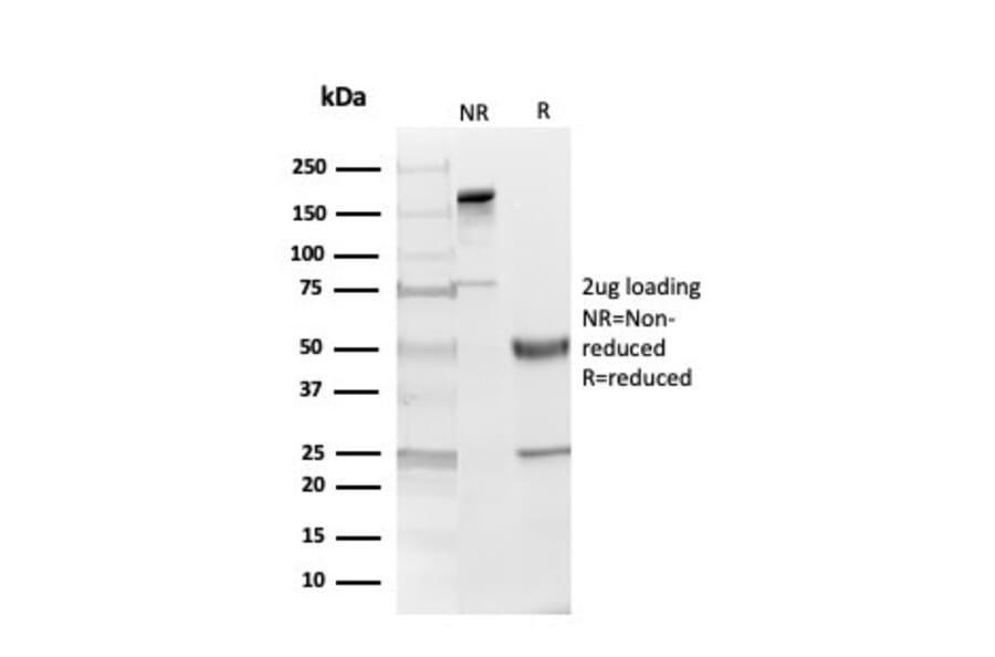 SDS-PAGE - Anti-Myelin Basic Protein Antibody [MBP/4274] (A249287) - Antibodies.com