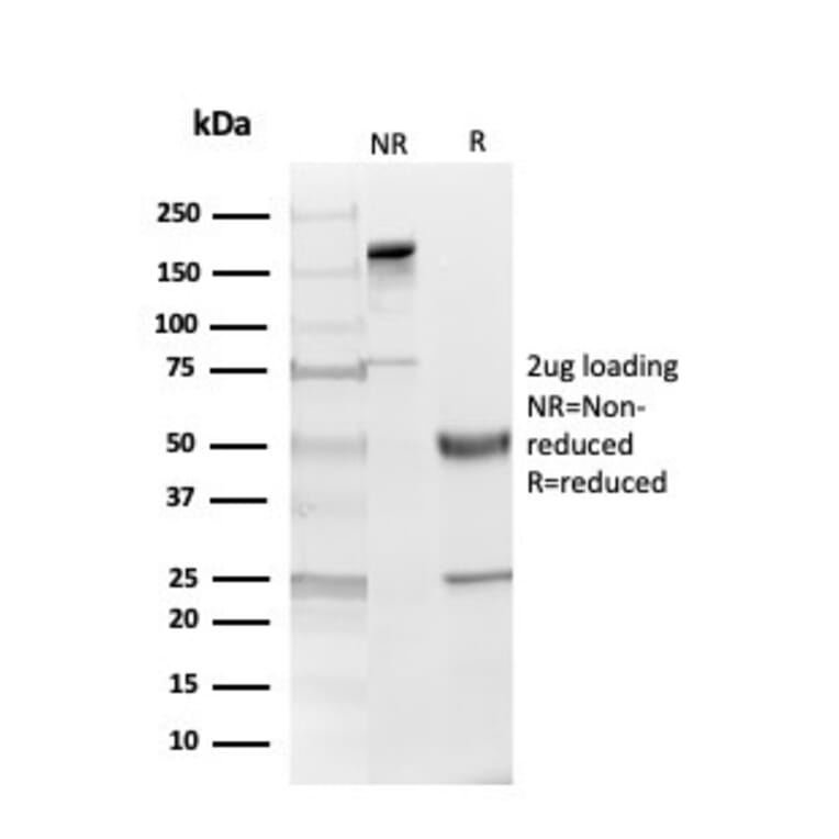 SDS-PAGE - Anti-Myelin Basic Protein Antibody [MBP/4274] (A249287) - Antibodies.com