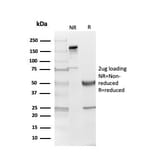 SDS-PAGE - Anti-Myelin Basic Protein Antibody [MBP/4274] (A249287) - Antibodies.com