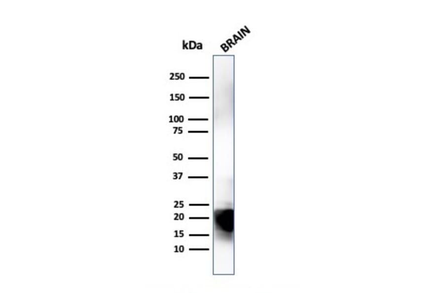 Western Blot - Anti-Myelin Basic Protein Antibody [MBP/4274] (A249287) - Antibodies.com