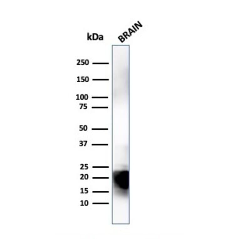 Western Blot - Anti-Myelin Basic Protein Antibody [MBP/4274] (A249287) - Antibodies.com
