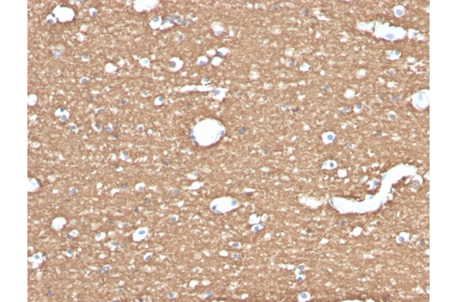 Immunohistochemistry - Anti-Myelin Basic Protein Antibody [MBP/4275] (A249288) - Antibodies.com
