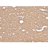 Immunohistochemistry - Anti-Myelin Basic Protein Antibody [MBP/4275] (A249288) - Antibodies.com