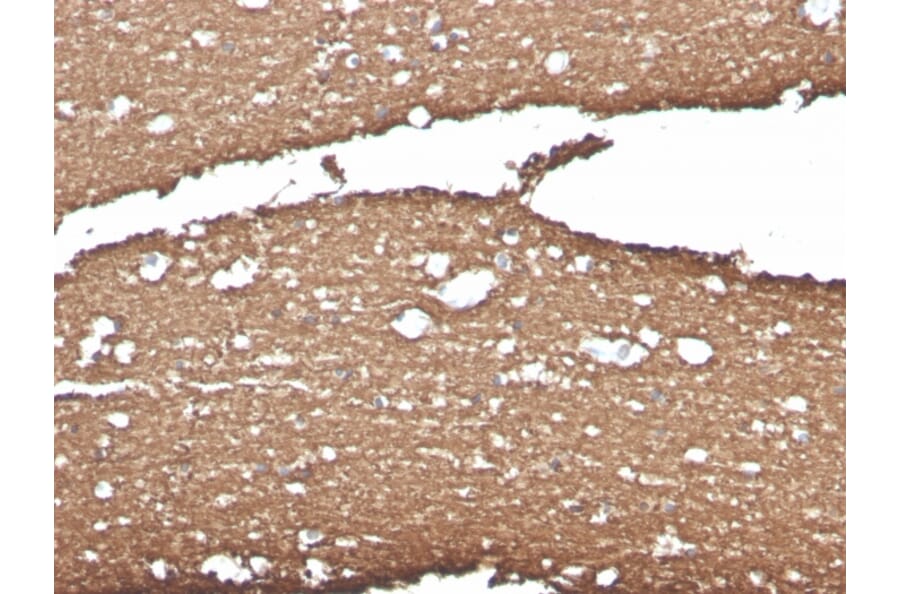 Immunohistochemistry - Anti-Myelin Basic Protein Antibody [MBP/4275] (A249287) - Antibodies.com