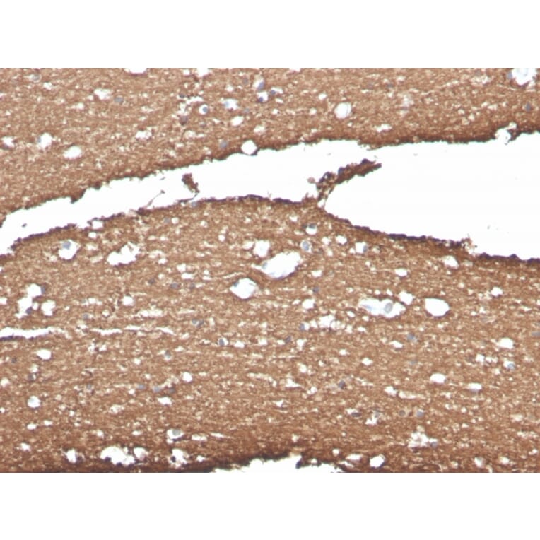 Immunohistochemistry - Anti-Myelin Basic Protein Antibody [MBP/4275] (A249287) - Antibodies.com