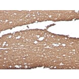 Immunohistochemistry - Anti-Myelin Basic Protein Antibody [MBP/4275] (A249287) - Antibodies.com