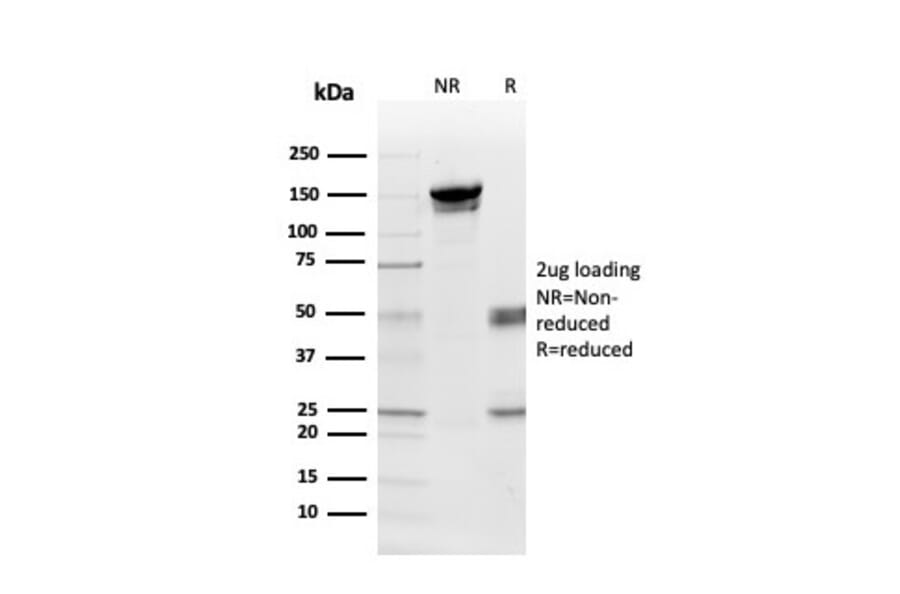 SDS-PAGE - Anti-Myelin Basic Protein Antibody [MBP/4275] (A249288) - Antibodies.com