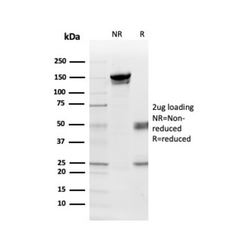 SDS-PAGE - Anti-Myelin Basic Protein Antibody [MBP/4275] (A249288) - Antibodies.com