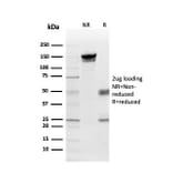 SDS-PAGE - Anti-Myelin Basic Protein Antibody [MBP/4275] (A249288) - Antibodies.com