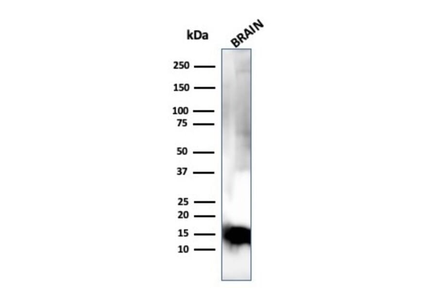 Western Blot - Anti-Myelin Basic Protein Antibody [MBP/4275] (A249288) - Antibodies.com