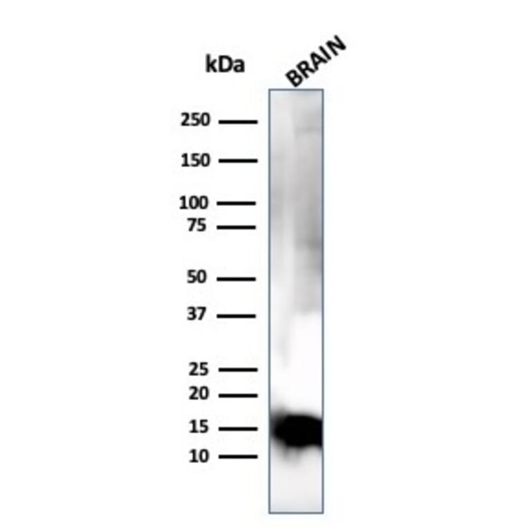 Western Blot - Anti-Myelin Basic Protein Antibody [MBP/4275] (A249288) - Antibodies.com