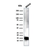 Western Blot - Anti-Myelin Basic Protein Antibody [MBP/4275] (A249288) - Antibodies.com