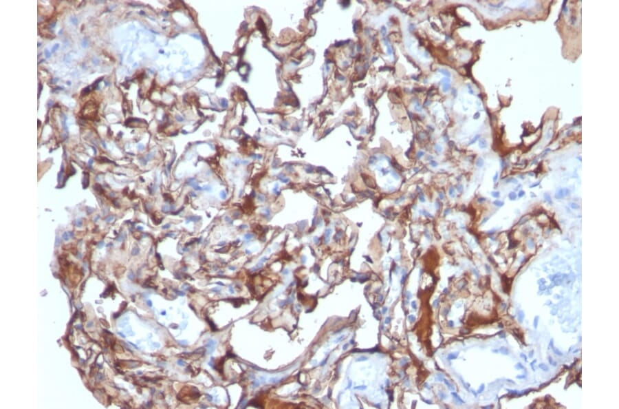 Immunohistochemistry - Anti-CD146 Antibody [MCAM/1101] (A249288) - Antibodies.com