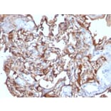 Immunohistochemistry - Anti-CD146 Antibody [MCAM/1101] (A249288) - Antibodies.com