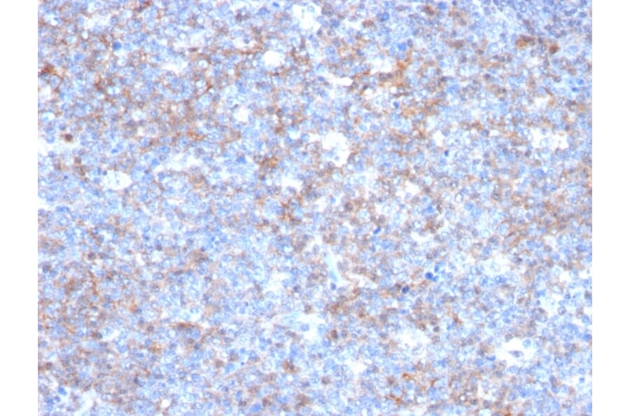 Immunohistochemistry - Anti-CD146 Antibody [C146/634] (A249292) - Antibodies.com