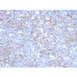 Immunohistochemistry - Anti-CD146 Antibody [C146/634] (A249292) - Antibodies.com