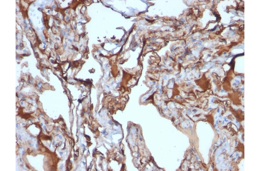 Immunohistochemistry - Anti-CD146 Antibody [MUC18/1130] (A249293) - Antibodies.com