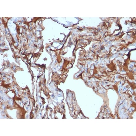 Immunohistochemistry - Anti-CD146 Antibody [MUC18/1130] (A249293) - Antibodies.com