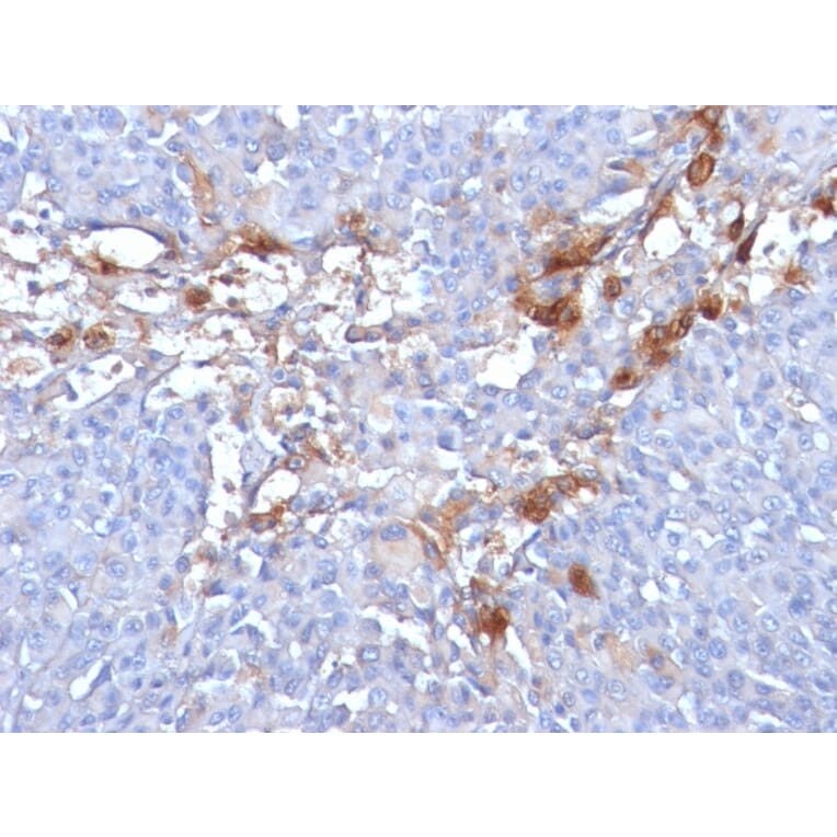 Immunohistochemistry - Anti-CD146 Antibody [MUC18/1130] (A249292) - Antibodies.com