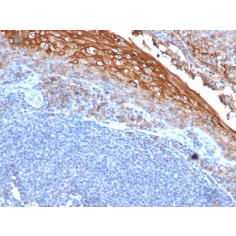 Immunohistochemistry - Anti-CD146 Antibody [MUC18/1130] (A249293) - Antibodies.com