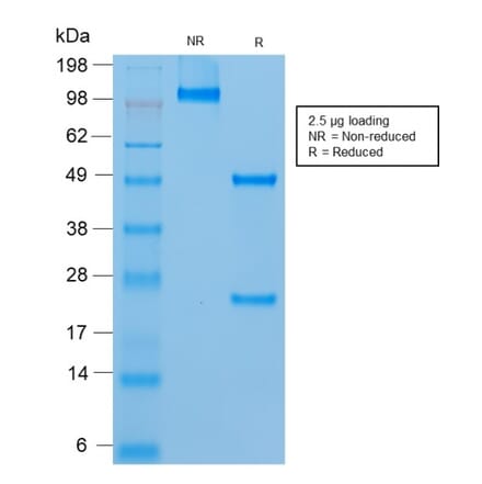SDS-PAGE - Anti-CD146 Antibody [rMUC18/1130] (A249294) - Antibodies.com