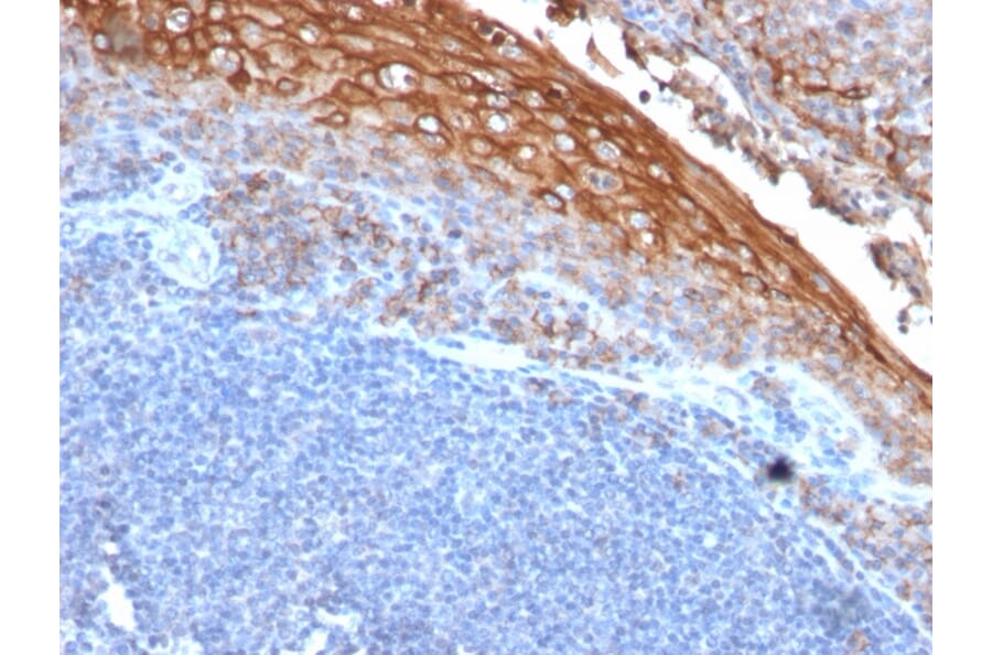 Immunohistochemistry - Anti-CD146 Antibody [rMUC18/1130] (A249293) - Antibodies.com