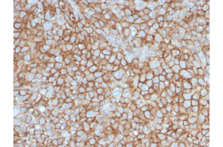 Immunohistochemistry - Anti-CD146 Antibody [MCAM/3046] (A249295) - Antibodies.com