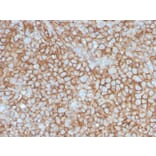 Immunohistochemistry - Anti-CD146 Antibody [MCAM/3046] (A249295) - Antibodies.com