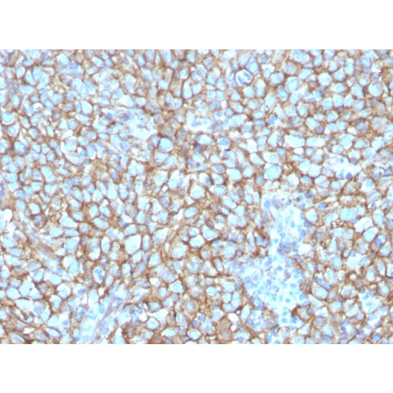 Immunohistochemistry - Anti-CD146 Antibody [MCAM/3048] (A249296) - Antibodies.com