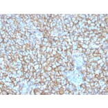 Immunohistochemistry - Anti-CD146 Antibody [MCAM/3048] (A249296) - Antibodies.com